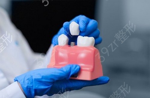 上海拜尔口腔门诊部整形价格表更新，附种植牙案例展示