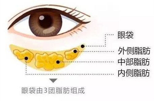 广州市人民医院整形科价格表（价目表）2020及祛眼袋案例