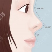 隆鼻失败后的修复方法有哪些