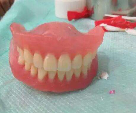 什么是树脂牙？树脂牙好不好？